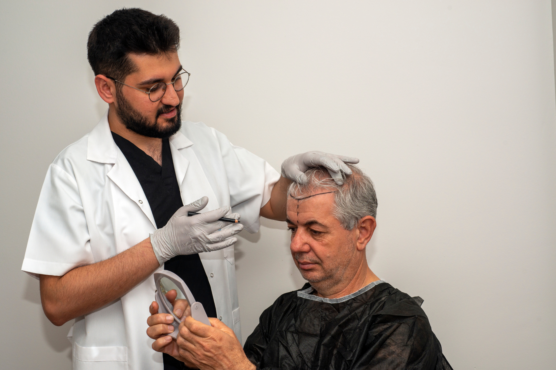 consultation greffe de cheveux