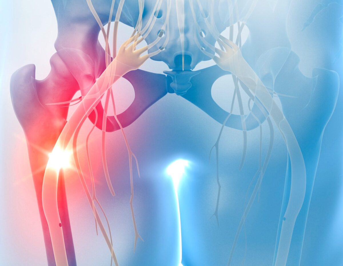 Comment le nerf sciatique peut-il influencer votre santé vésicale ? Discussions et conseils sur notre forum
