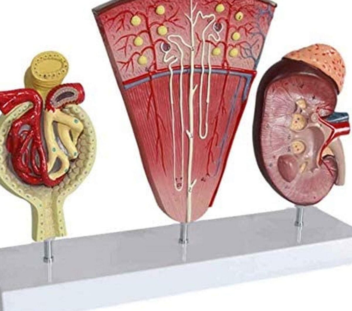 Le calice rénal: Comprendre son rôle essentiel dans la santé des reins