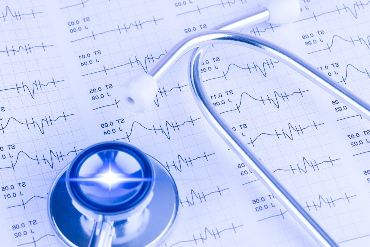Les médicaments anti-arythmiques : la clé pour contrôler les battements irréguliers du cœur ?