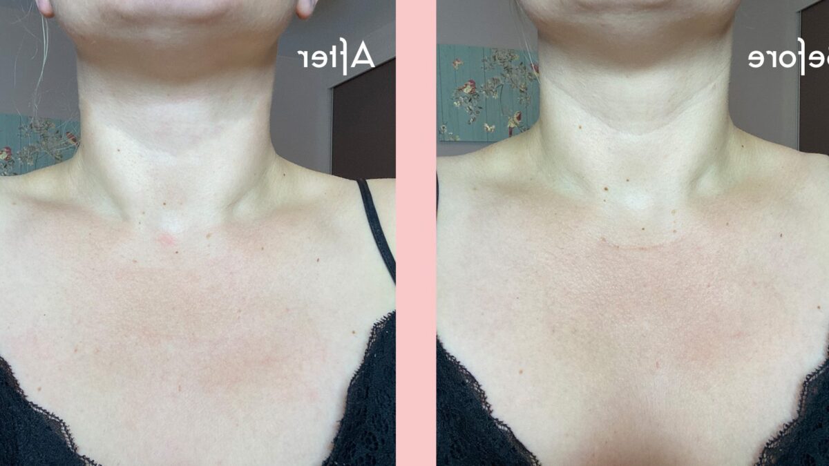 Patch OhSkin : Avis et témoignages de satisfaction